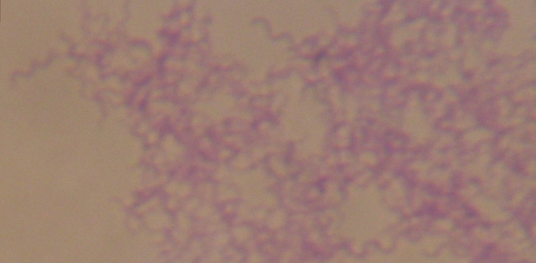 На этом снимке изображена колония пурпурной (несерной) бактерии Rhodospirillum - примера фотосинтезирующей бактерии, содержащей только хлорофилл a.