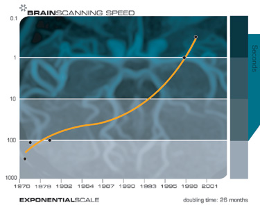 Скорость сканирования мозга (сек)