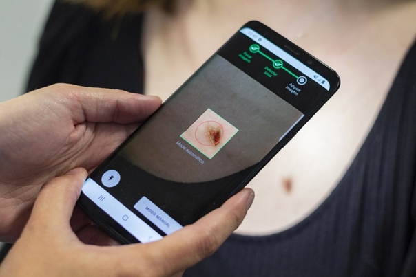 Диагностика рака становится доступнее благодаря умному приложению на смартфоне. Источник