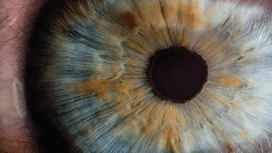 Этот глаз нарисовала нейросеть. Как вам детализация радужной оболочки (области вокруг зрачка)? Впрочем, знающие люди говорят, что ИИ не может нормально рисовать сами зрачки - они получаются неестественной формы. Но то ли еще будет.