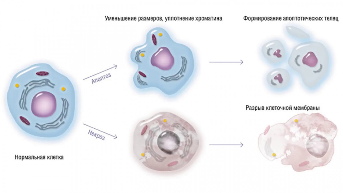 Редукция происходит во время. Апоптоз клетки микроскоп. Старение и гибель клеток апоптоз и некроз. Гибель клетки апоптоз и некроз. Апоптоз опухолевых клеток.