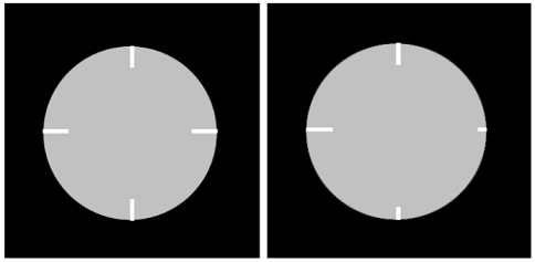 Рис. 7. Схема изображений элементов позиционирования фантома PH-9 для случаев точного и неточное позиционирования