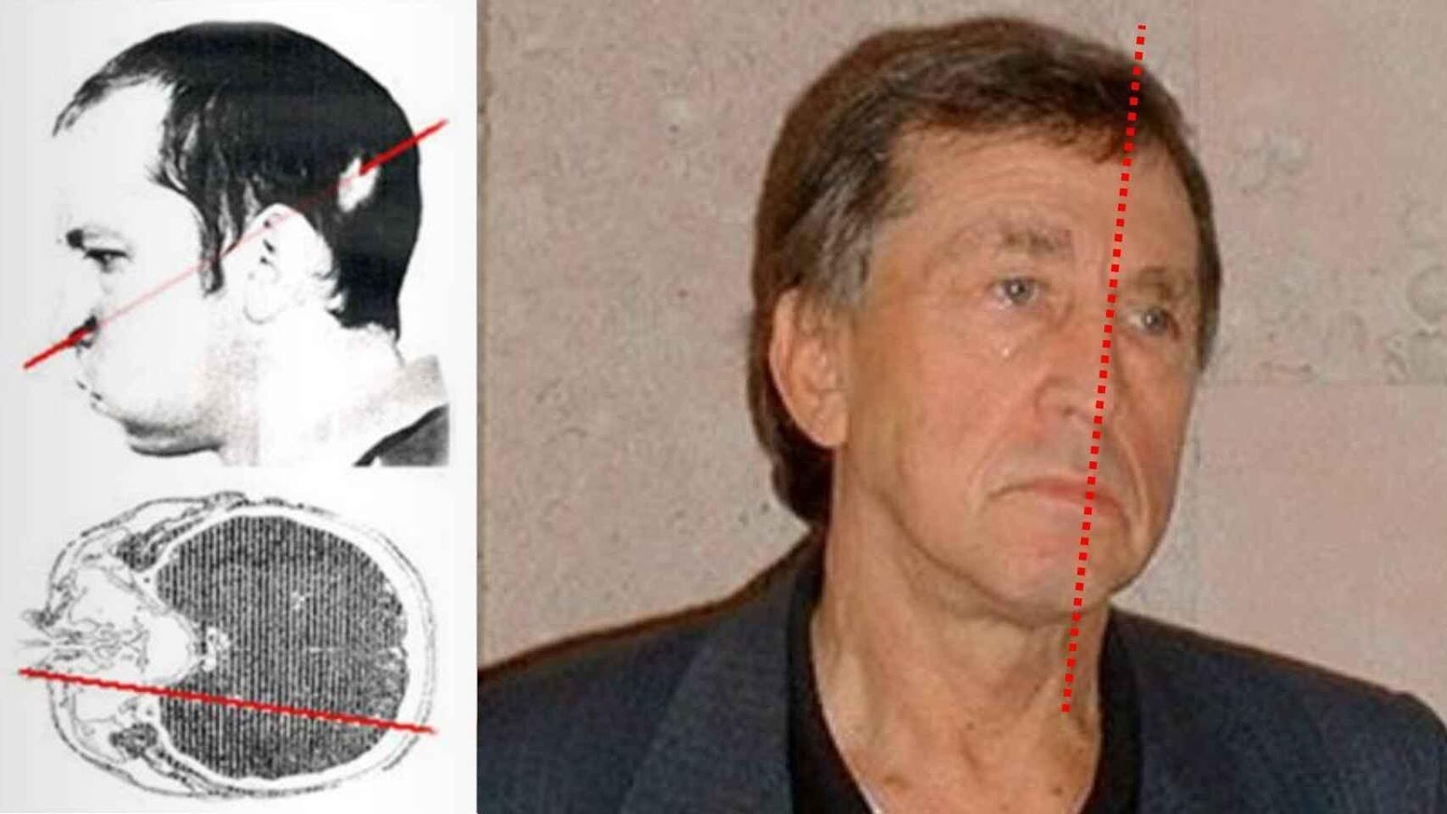 Natural wrinkles and signs of aging are visible on one side of Anatoly's face, but not on the other.