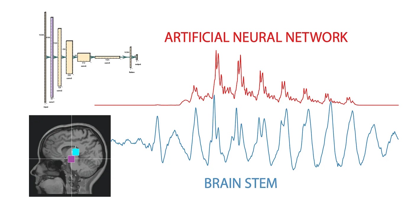 Пики активности искусственной нейросети (сверху) и мозгового ствола (снизу) совпадают при восприятии одной и той же согласной. Источник