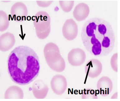 Моноциты (предшественники макрофагов) и нейтрофилы в периферической крови.  