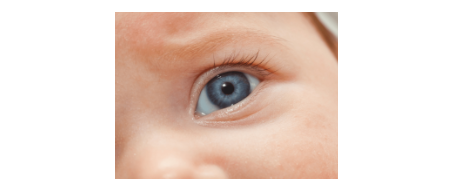 Рис. 11. Голубой цвет глаз – проявление рассеяние Тиндаля. Наблюдается, в частности, у младенцев, у которых количество пигмента меланина в радужной оболочке глаза меньше, чем у взрослого человека.