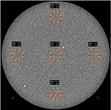 Рис. 24. Изображение слоя фантома CT ACR 464, отмечены области интереса для оценки уровня шума и однородности поля, адаптировано из [APM-223]