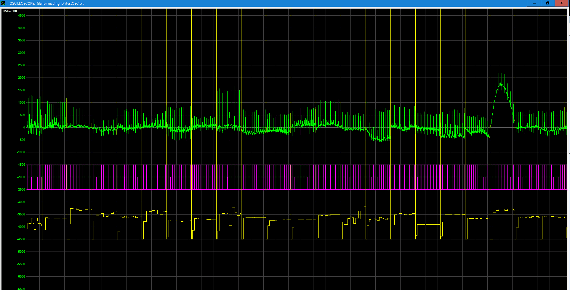 Рис. 3.  Сигнал ЭКГ ( зеленый цвет )  22 больных 10 секундной длительностью из  базы данных сайта  https://physionet.org. Сигнал алгоритма (фиолетовый цвет) и график результата расчета  пульса (желтый цвет).