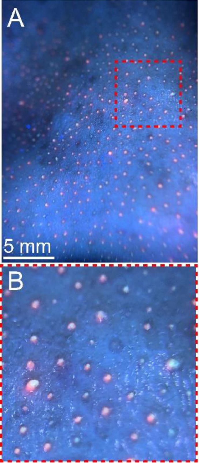 (А) Фотография кожи переносицы добровольца в ультрафиолетовом излучении. (Б) Крупный план выделенного на “А” участка