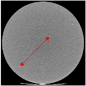 Рис. 20.  Изображение слоя с парой точечных объектов для проверки линейного расстояния фантома CT ACR 464