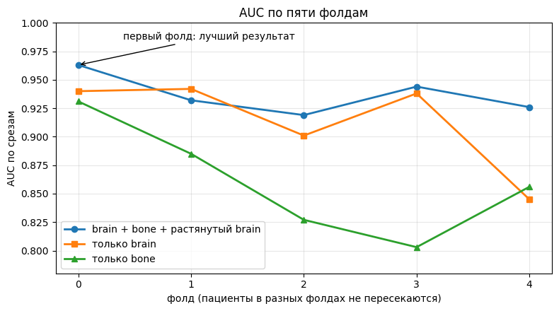 Рисунок 2 - График AUC по пяти фолдам для трёх входов Рисунок 2 - График AUC по пяти фолдам для трёх входов