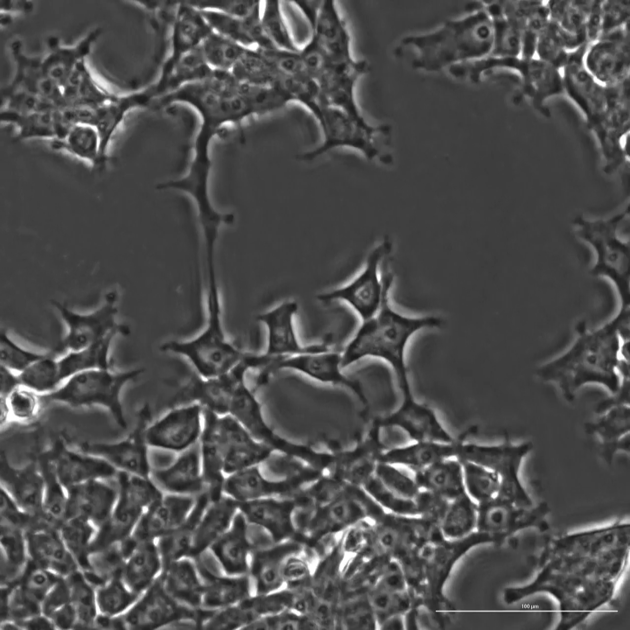 Клетки человека, гены которого были изменены с помощью OpenCRISPR-1