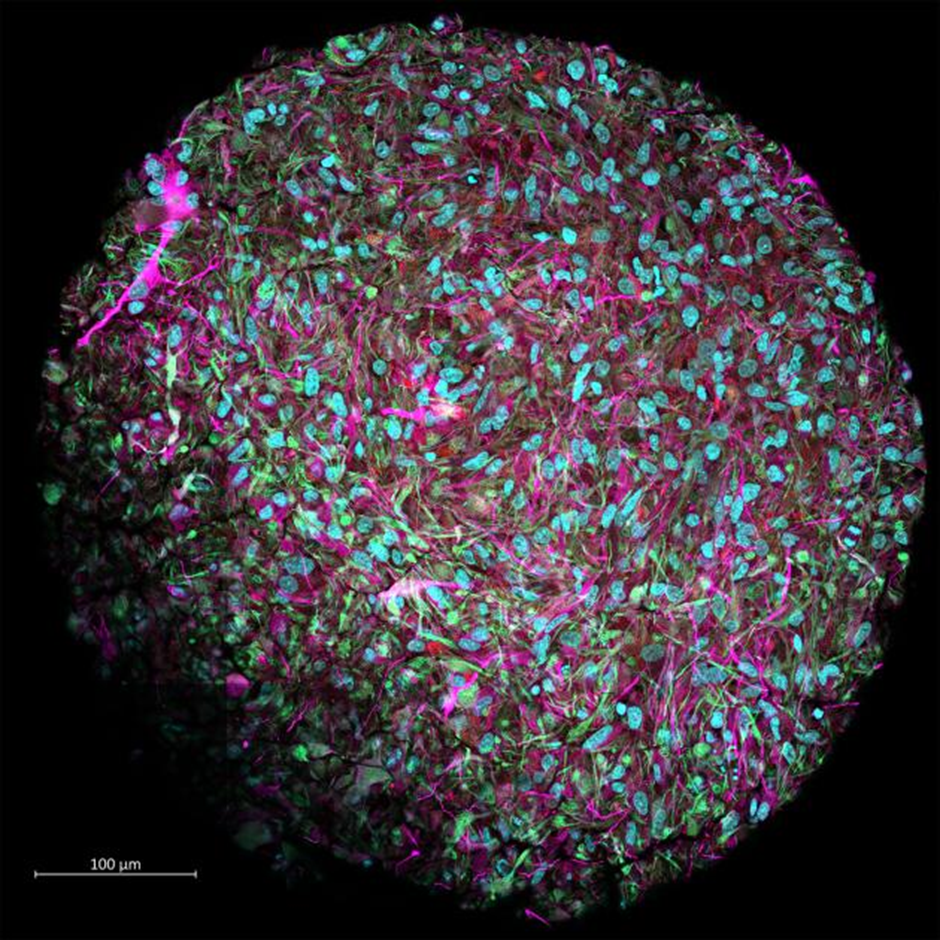 Органоид из клеток мозга