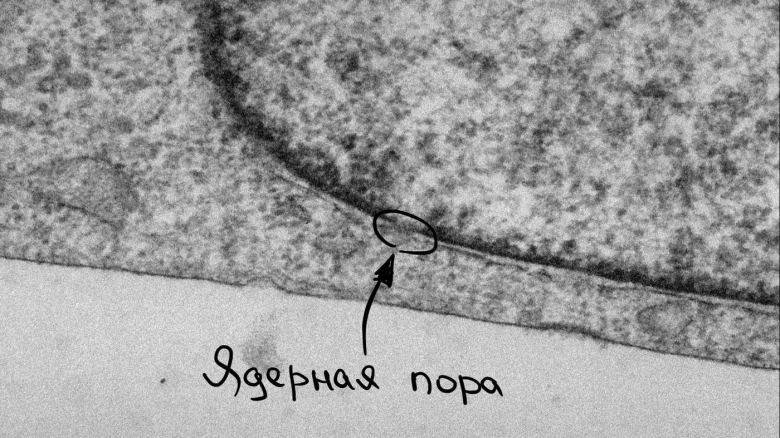 Для тех, кто шарит: на этой фотке видно, что у ядра 2 мембраны, а у самой клетки всего одна. А ещё в ядре есть ядерные поры: через них гены общаются со всей остальной клеткой Для тех, кто шарит: на этой фотке видно, что у ядра 2 мембраны, а у самой клетки всего одна. А ещё в ядре есть ядерные поры: через них гены общаются со всей остальной клеткой