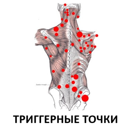 триггерные точки на теле человека с описанием