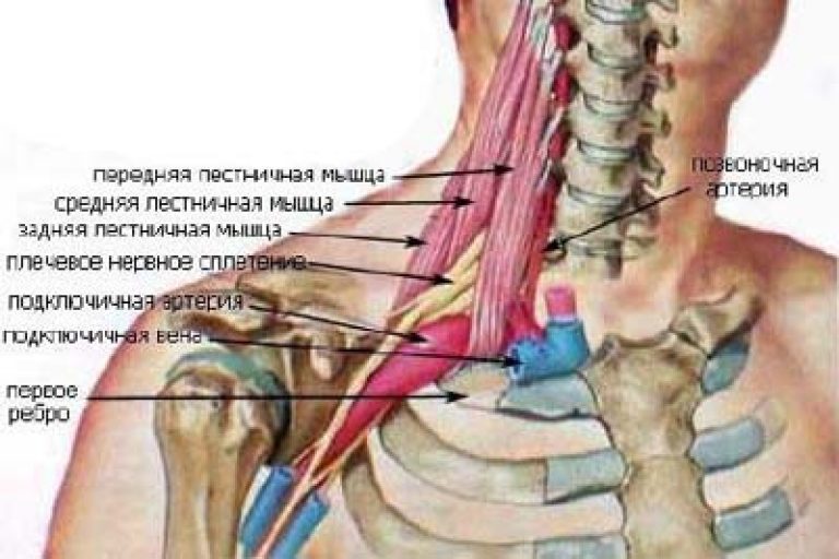 Топография лестничных мышц и плечевого сплетения