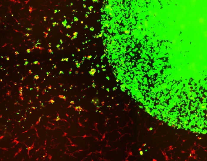 Стволовые клетки (зелёные) высвобождаются из капсулы, отслеживают и убивают опухолевые клетки ГБМ (красные)