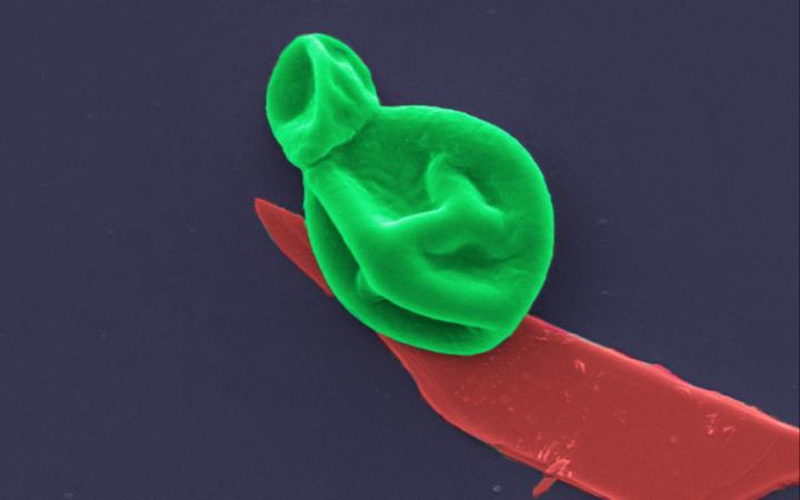 Клетка грибка, взаимодействующая с черным фосфором. Источник: Мельбурнский королевский технологический университет 