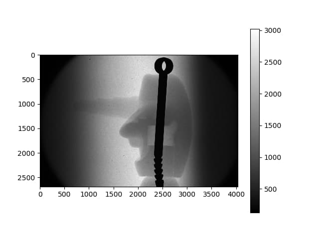 Рентгенограмма головы снеговика 