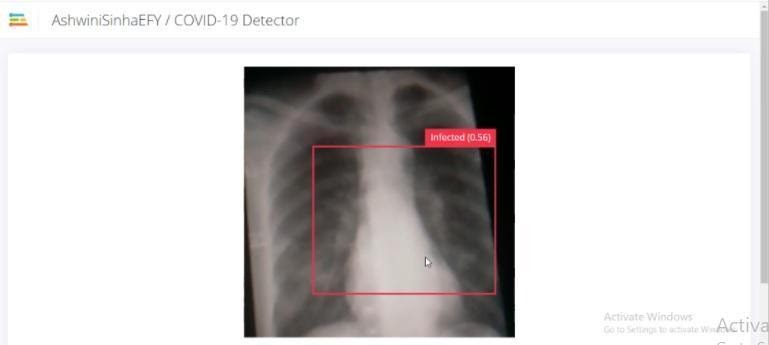 25. Обнаружение вирусной инфекции внутри лёгкого на рентгеновском снимке