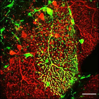 Клетка Пуркинье окрасилась зелёным после слияния с клеткой из пересаженного костного мозга, несущего ген зелёного флуоресцентного белка.