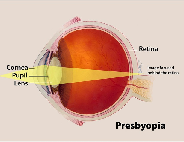 Терапия красным светом может улучшить снизившееся из-за возраста зрение