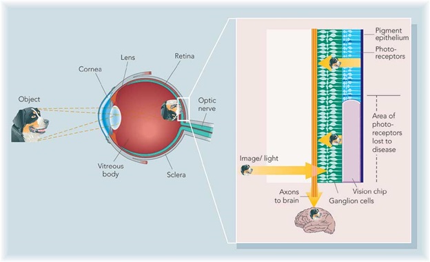 Artificial Silicone Retina