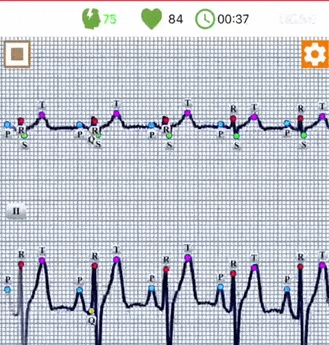 Мобильная диагностика: как работают датчики уровня кислорода, пульса, ЭКГ и шума | Смарт-часы и фитнес-браслеты | Блог | Клуб DNS