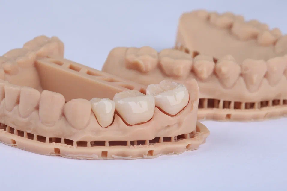 Как 3D-принтеры захватывают стоматологию и почему это прекрасно